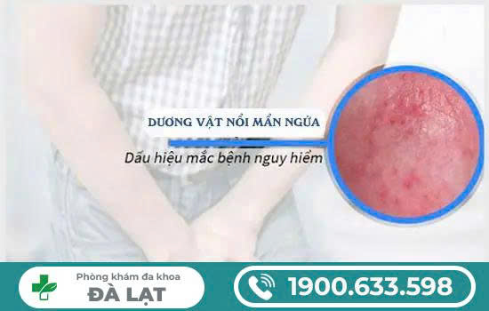 Hình ảnh minh họa